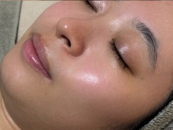 アテ(Ate)の写真/【韓国注目!ツヤ肌ケア】話題の美容機器でワンランク上のお手入れ