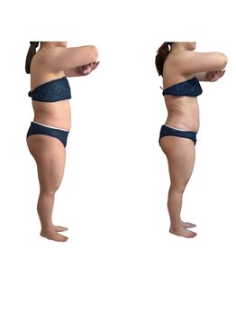 スズ(SUZU)の写真/サイズダウンへ導く！徹底燃焼で痩せたいあなたをサポート☆体質改善で目指す理想のボディライン♪