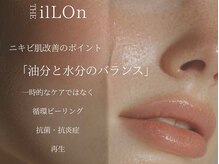 ブルーム(Bloom)