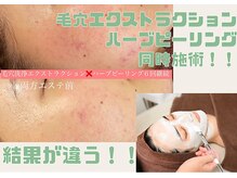 ルペルル(Le’perle。)