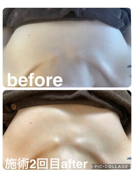 ギンザアール(GINZA R.)/バストアップ♪