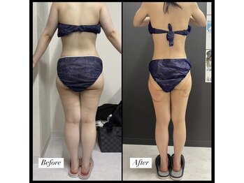 エムズビューティーサロン(M's Beauty Salon)/お客様Before After