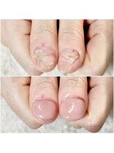 グラシナ なんば店/即日長さだしスキンカラー仕上げ