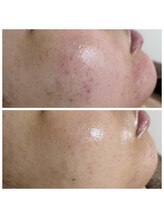 ジャスミン(Jasmine)/