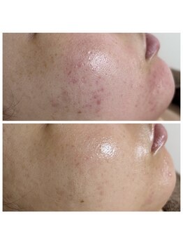 ジャスミン(Jasmine)/