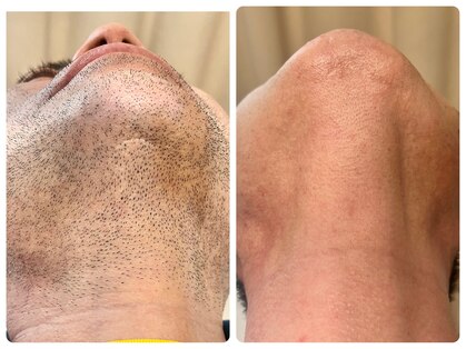 シシエル(CHICIEL)の写真