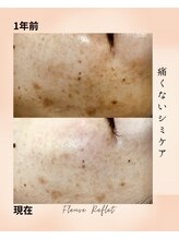 フルーヴ ルフレ(Fleuve Reflet)/敏感肌だから無理に取らない！