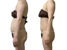 スリーピングビューティー(Sleeping Beauty)/