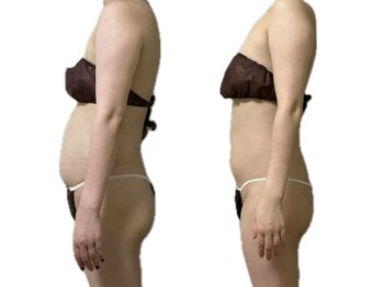 スリーピングビューティー(Sleeping Beauty)/