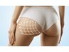 ★桃尻EMSでヒップアップ★IPLでつるつるうるうる★4500円で美尻★