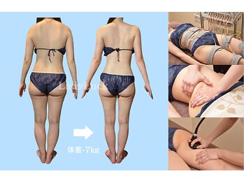 レディラック 大阪梅田本店(Lady Luck)の写真/13種類の痩身機器から体質で選定し、気になる凹凸感にアプローチ！理想のボディラインを整える♪