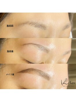 クレー(Klee)/アイブロウリフト