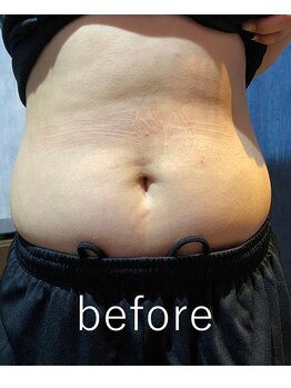 カナウ(kanau)/トリプルボディシェイプ