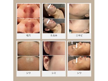 ルヴィショップ 沖縄(REVI SHOP)