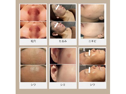 ルヴィショップ 沖縄(REVI SHOP)の写真