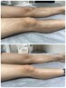 夏が来る前に！【men's 】“即！ツルスベ肌♪”両脚丸ごと！WAX脱毛＋光脱毛