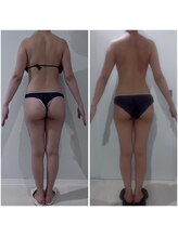 リブ シャルム(Lib Charm)/シークレシー全身1回施術