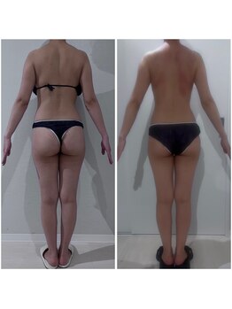 リブ シャルム(Lib Charm)/シークレシー全身1回施術