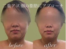 サロンハート(Salon Heart)/