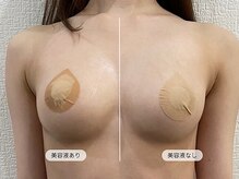 ルルミリ 心斎橋(Lulumili)/バストクリーム