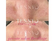 リセラージュ(Recellage)