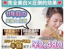 ホワイトニングショップ 越谷せんげん台店