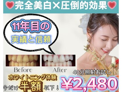 ホワイトニングショップ 越谷せんげん台店の写真