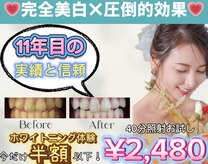 ホワイトニングショップ 越谷せんげん台店