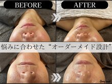 アングレイス(Anngrace)の雰囲気（【技】と【真ごころ】で今までにない効果実感をお届けします。）