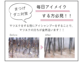 ミネアート 錦糸町店(mineart)/まつげダニ予防☆アイシャンプー