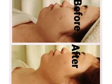 リサスミー(Lithas Me)/小顔もお任せください！