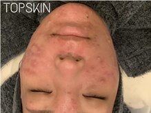 トップスキン 名駅(TOPSKIN)/製薬会社発！TCLINEで肌質改善