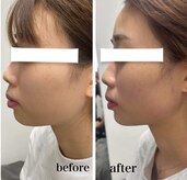 ラムールボーテ(L'AMOUR BEAUTE)