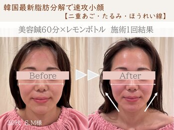 ネテマテ 表参道(netemate)