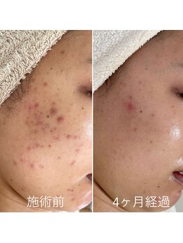 シェノン 赤坂大濠店/