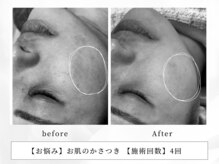 レッド(RED)/お肌のがさつき、ごわつきにも