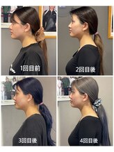 ワイルドボディ(WILD BODY)/小顔フェイスリンパ