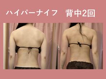 ハッテンビューティーパーク 神戸店(Hatten Beauty Park 810)