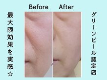 カノン(KANON)/グリーンピール