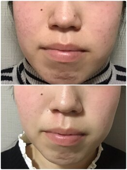 Ms.やまとなでしこ/BBLフェイシャル