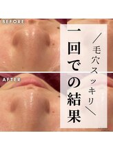 オリオンドットエスツー(Orion.S2)/【Before→After】