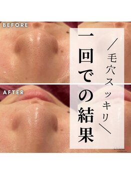 オリオンドットエスツー(Orion.S2)/【Before→After】