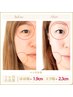 劇的!若見えメソッド【小顔矯正】顔の歪み&エラ張りの小顔ケアで１回り若見え