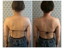 ココア(CoCoa)/肩甲骨洗浄