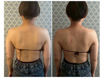 ココア(CoCoa)/肩甲骨洗浄