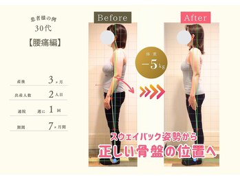 ココア整体 岐阜店(cocoa整体)/産後骨盤矯正/整体