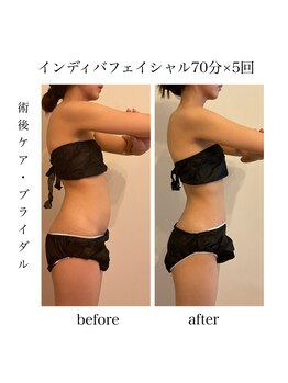 ファミーユ 名古屋店/【術後ケア】顎下吸引後ケア