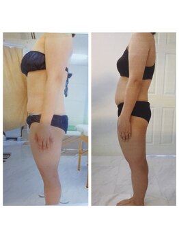 痩身デトックスサロン ベルチェ/◆ブライダル前に大改造◆