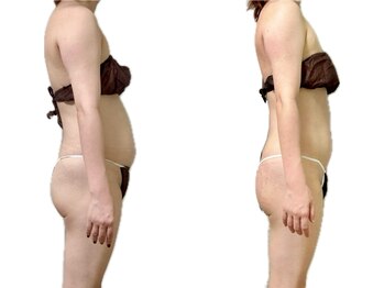 スリーピングビューティー(Sleeping Beauty)/