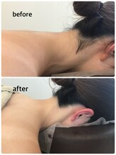 アジサイ(Ajisai)/結果重視の脱毛